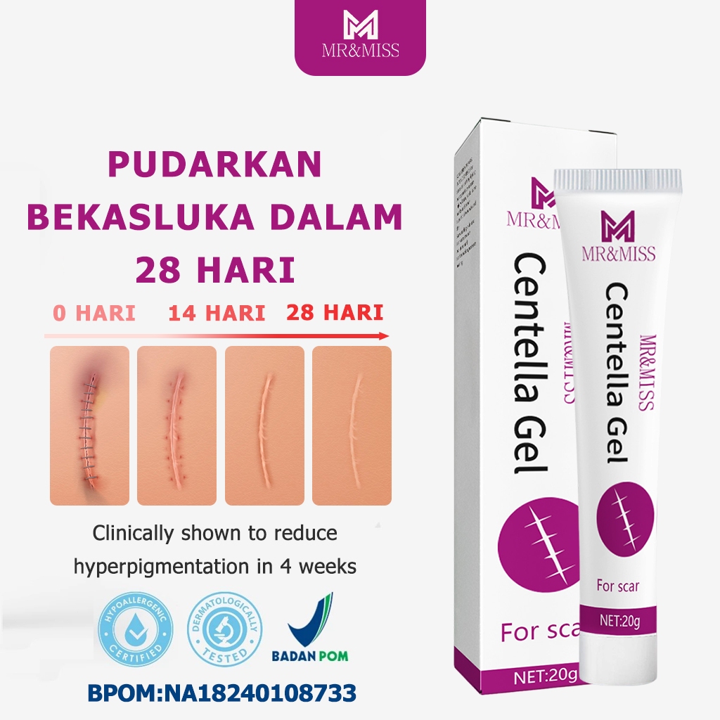 Cream penghilang bekas luka koreng Menghilangkan bekas luka Salep penghilang bekas luka hitam Salep 