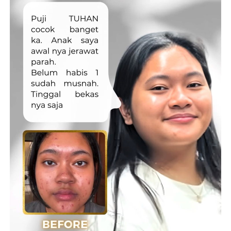 BEST TERLARIS ECER TONER PEMBERSIH WAJAH MUKA SKIN BARRIER PELEMBAB NOMOR BPOM ADA IZIN EDAR INDONES