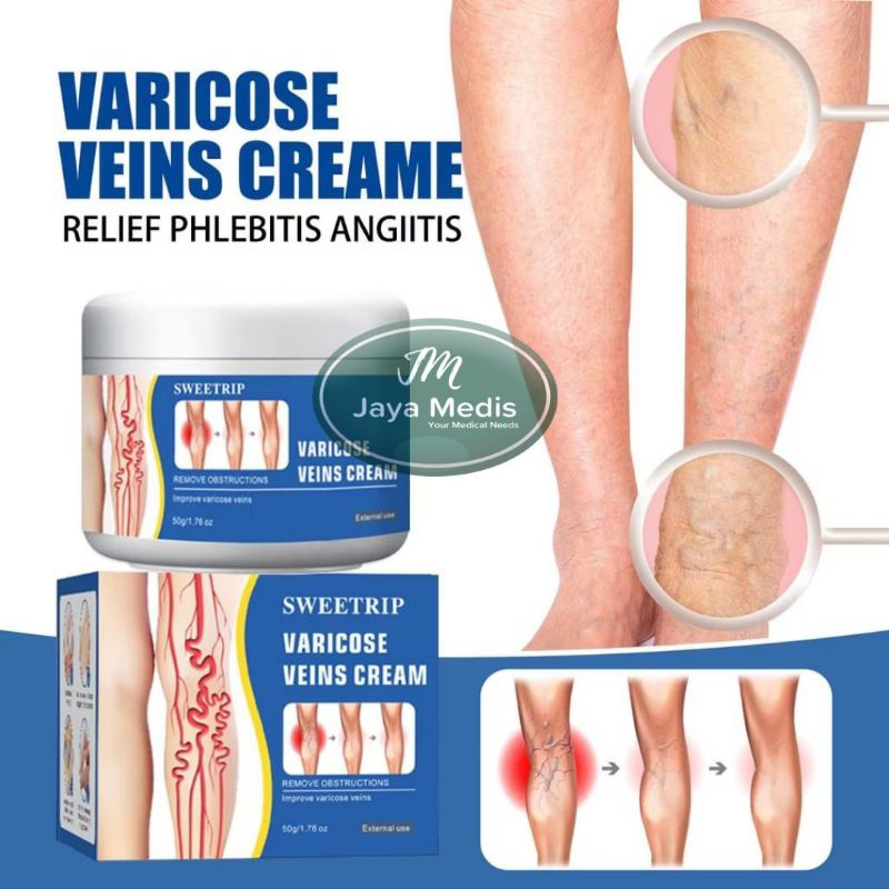 SWEETRIP Cream Varises - Salep Varises