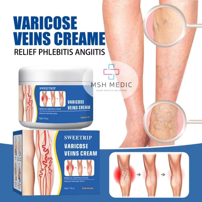 SWEETRIP Cream Varises - Salep Varises