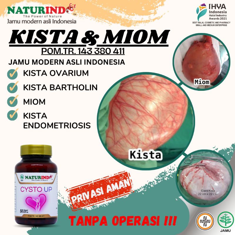 obat herbal kista cysto miom kista endometriosis ovarium tiroid bartholin coklat pcos naturindo
