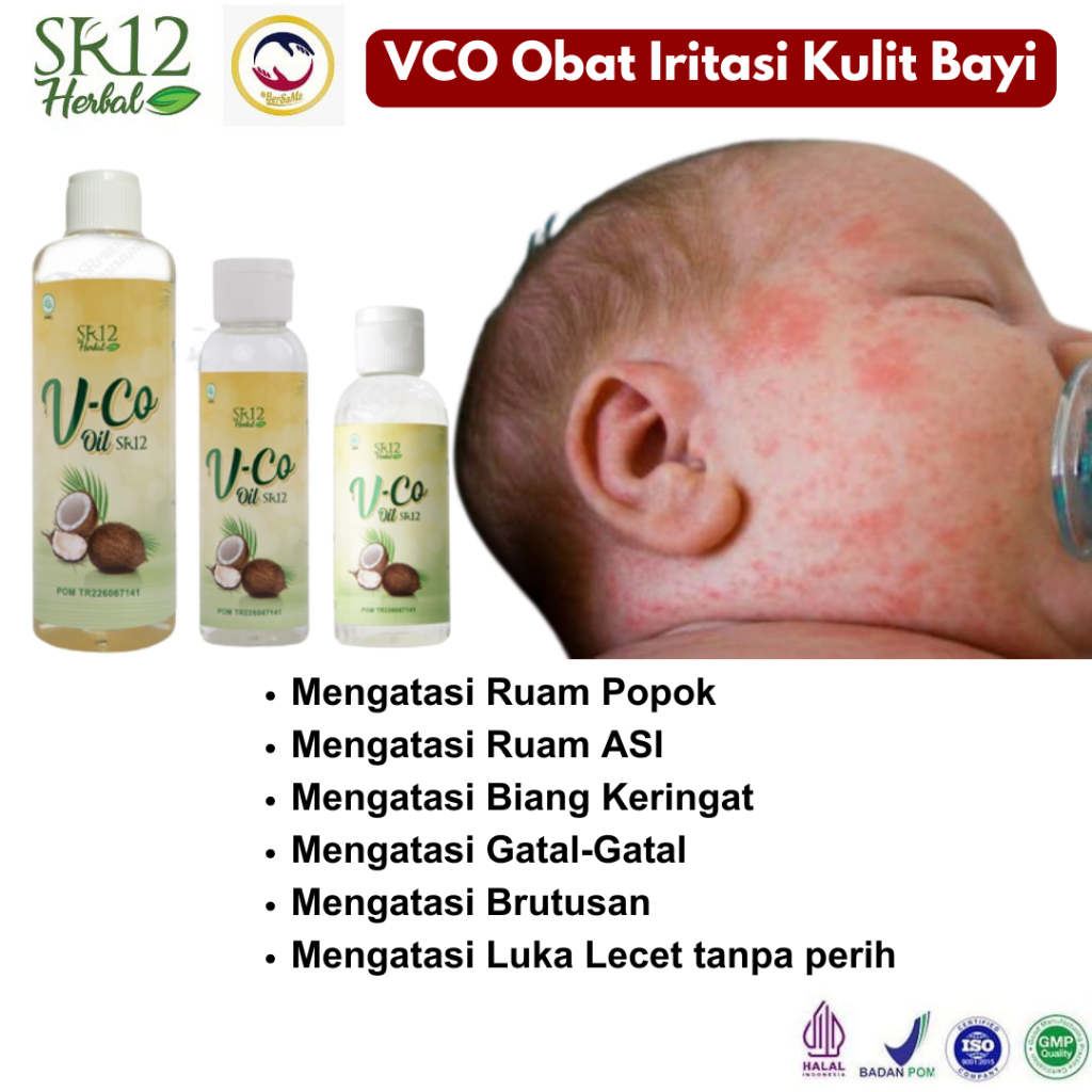 Minyak Kelapa Virgin Coconut Oil Obat Oles untuk Ruam Pipi dan Popok pada Bayi serta Dewasa