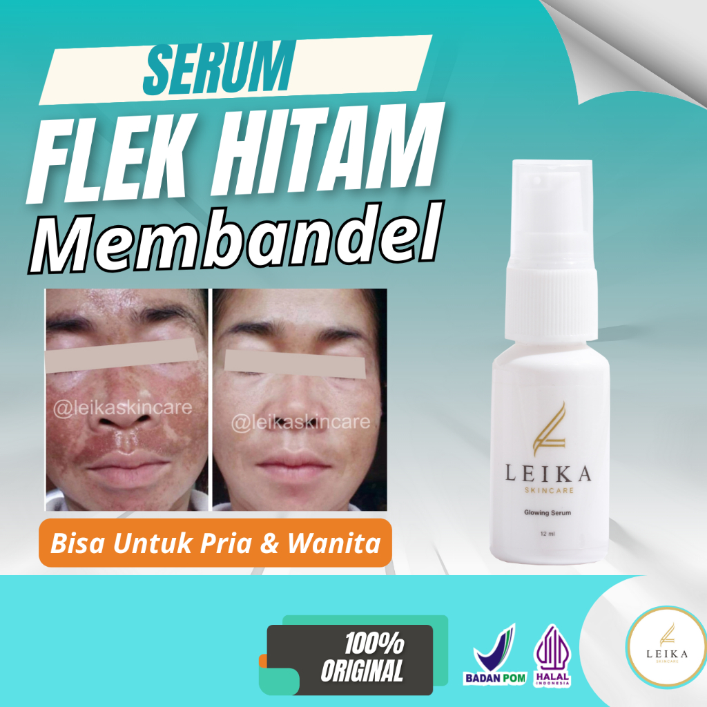 Penghilang flek hitam di wajah menghilangkan flek hitam di wajah flek hitam di wajah serum untuk fle