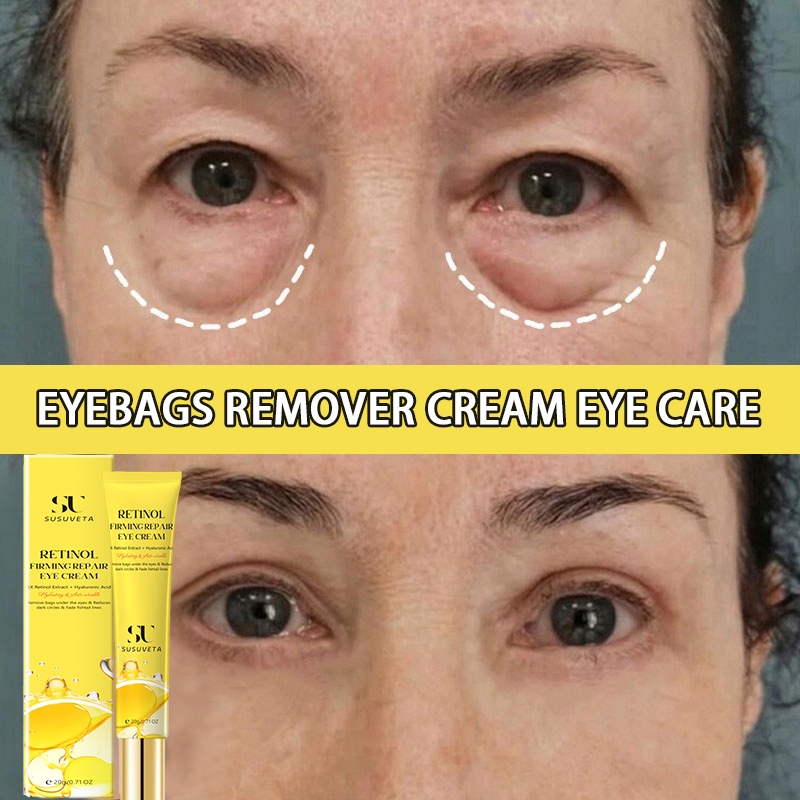 Eye cream kantung mata penghilang kantung mata panda dan kantung mata ampuh penghilang mata panda 20