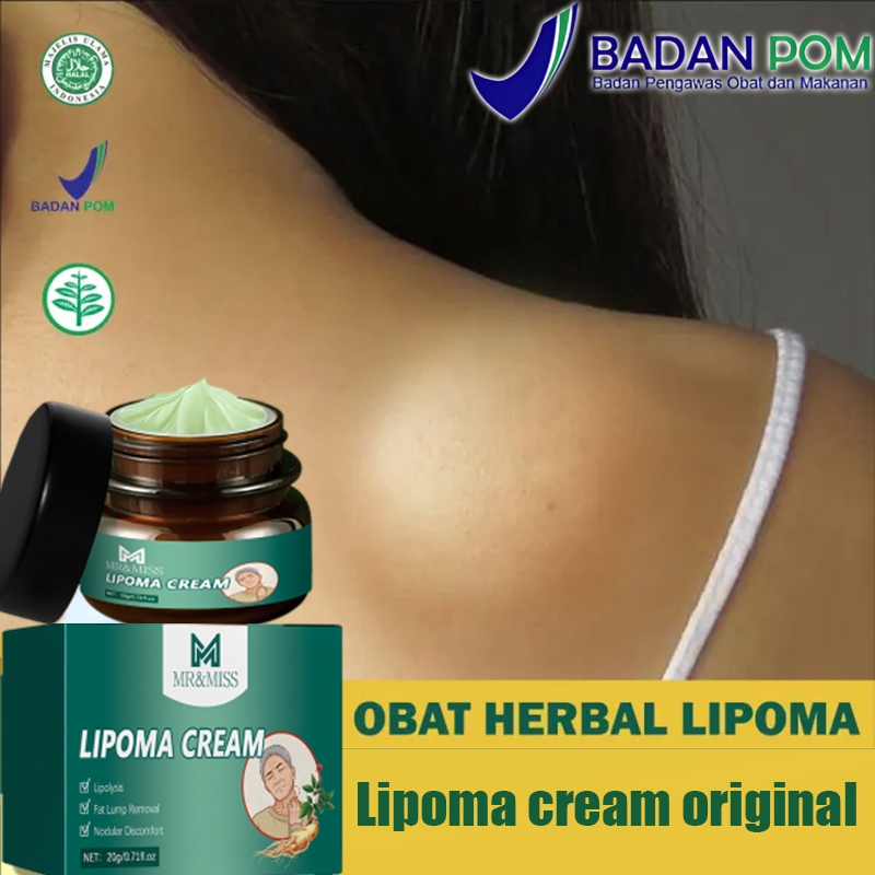 Lipoma cream original Obat benjolan Lipoma removal cream original Obat lipoma Salep lipoma salep ben