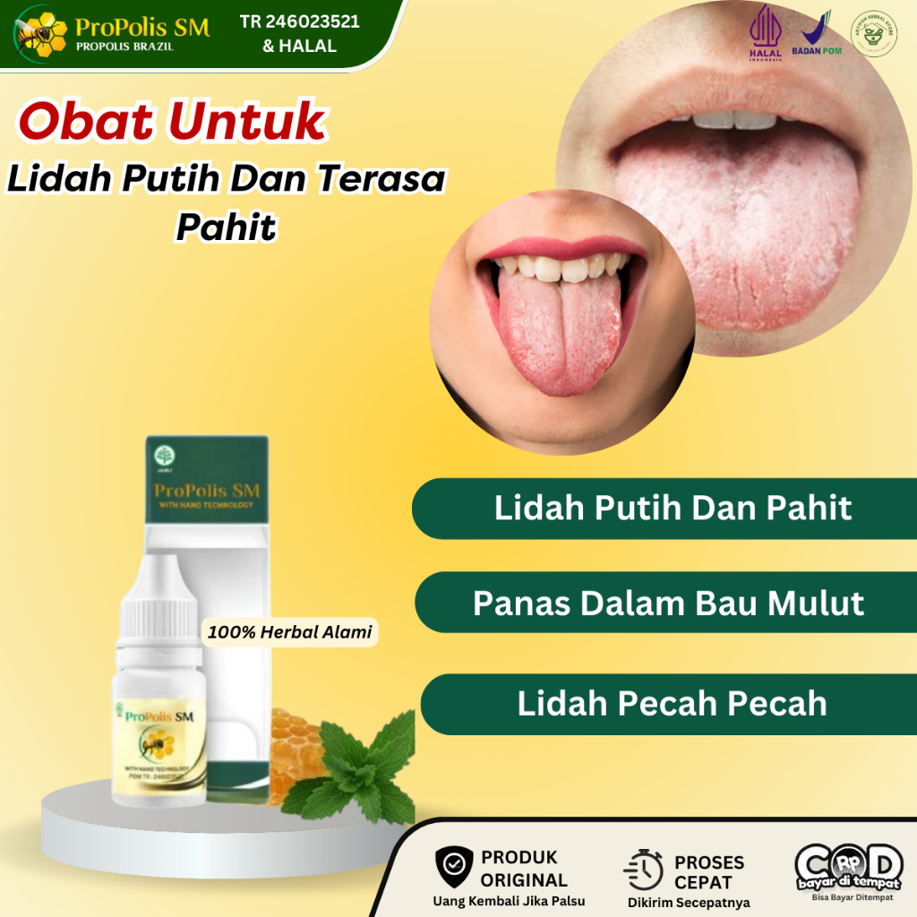 Obat Jamur Lidah Putih, Obat Radang Lidah Putih, Obat Mulut Pecah Pecah, Obat Infeksi Jamur, Obat Li