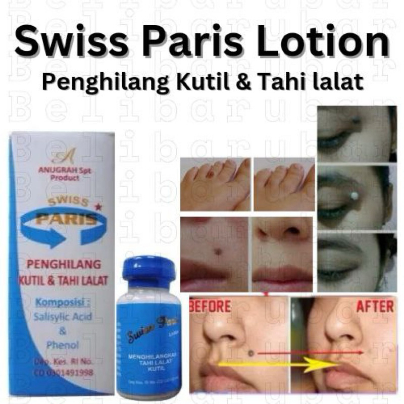 Swiss Paris Penghilang Tahi Lalat dan kutil Swiss Paris Lotion Original 100% Swiss Paris Lotion Peng