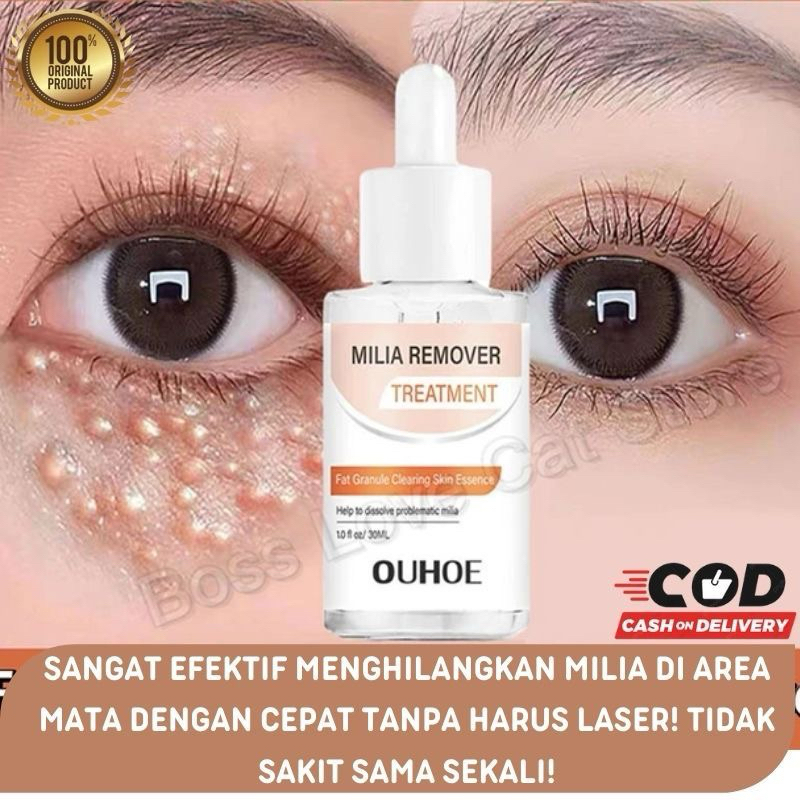 Milia remover serum penghilang perontok milia bintik putih mata Ouhoe Milia Remover Treatment Oil-Fr