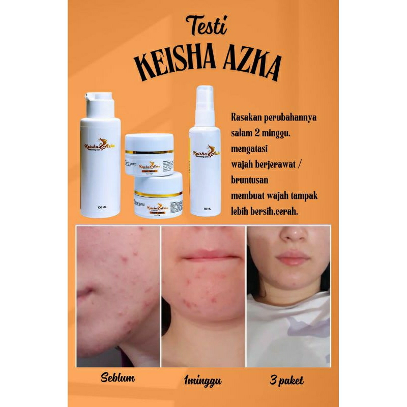 COD paket skincare Keisha Azka khusus reseller  paket