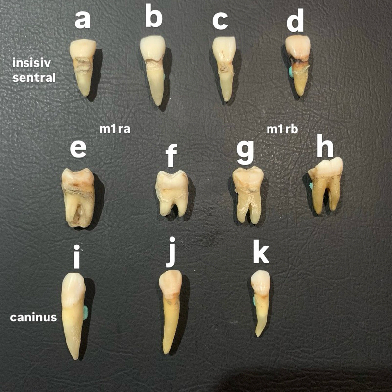 jual gigi asli murah insisiv caninus molar 1 rahang atas bawah