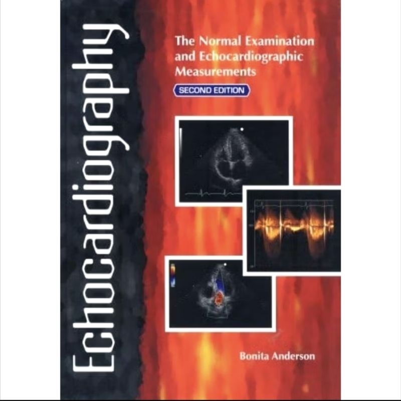 Echocardiography by bonita Anderson