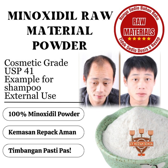 Minoksidil sulfat 15gr minoxidil murni minoxidil bubuk penumbuh rambut