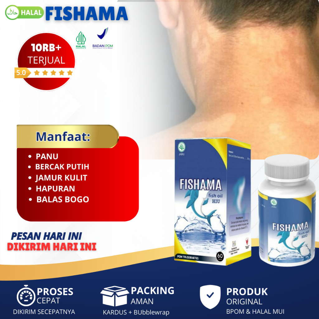 Obat Penghilang Panu Seluruh Badan Panu Di Wajah Panu di Leher Panu Di Punggung Menghilangkan Panu B