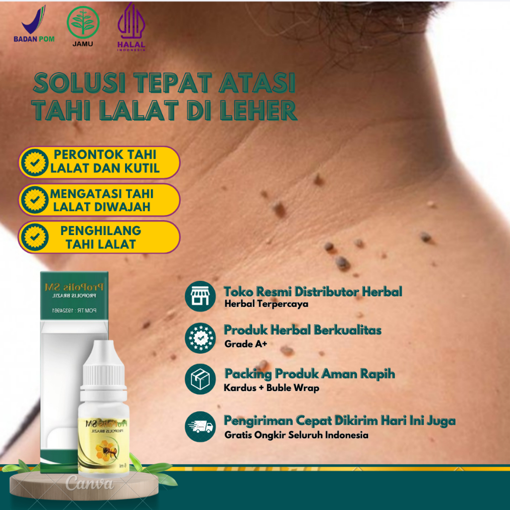 Obat Kutil Oles, Obat Penghilang Kutil Di Leher, Obat Perontok Kutil, Obat Penghilang Papiloma Di Le