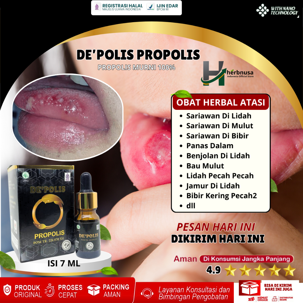 Obat Sariawan Di Lidah Sariawan Di Mulut Sariawan Di Bibir Panas Dalam Benjolan Di Lidah Bau Mulut L