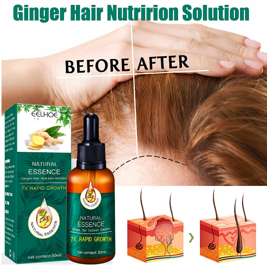Natural Essence Ginger Hair Solution Penumbuh Serum Perawatan Rambut