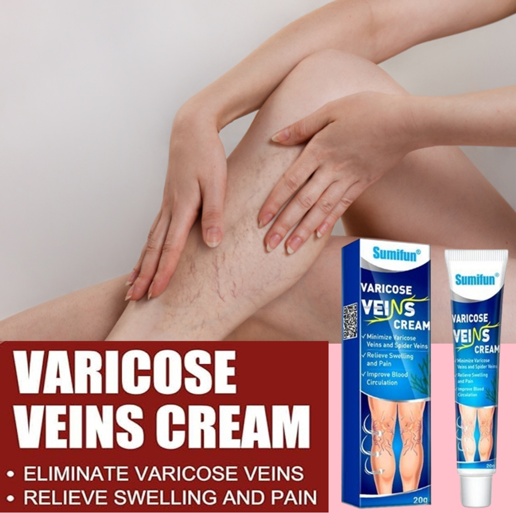 Obat varises cream varises original Varicose Veins Cream Obat Varises Paling Ampuh Salep Penghilang 