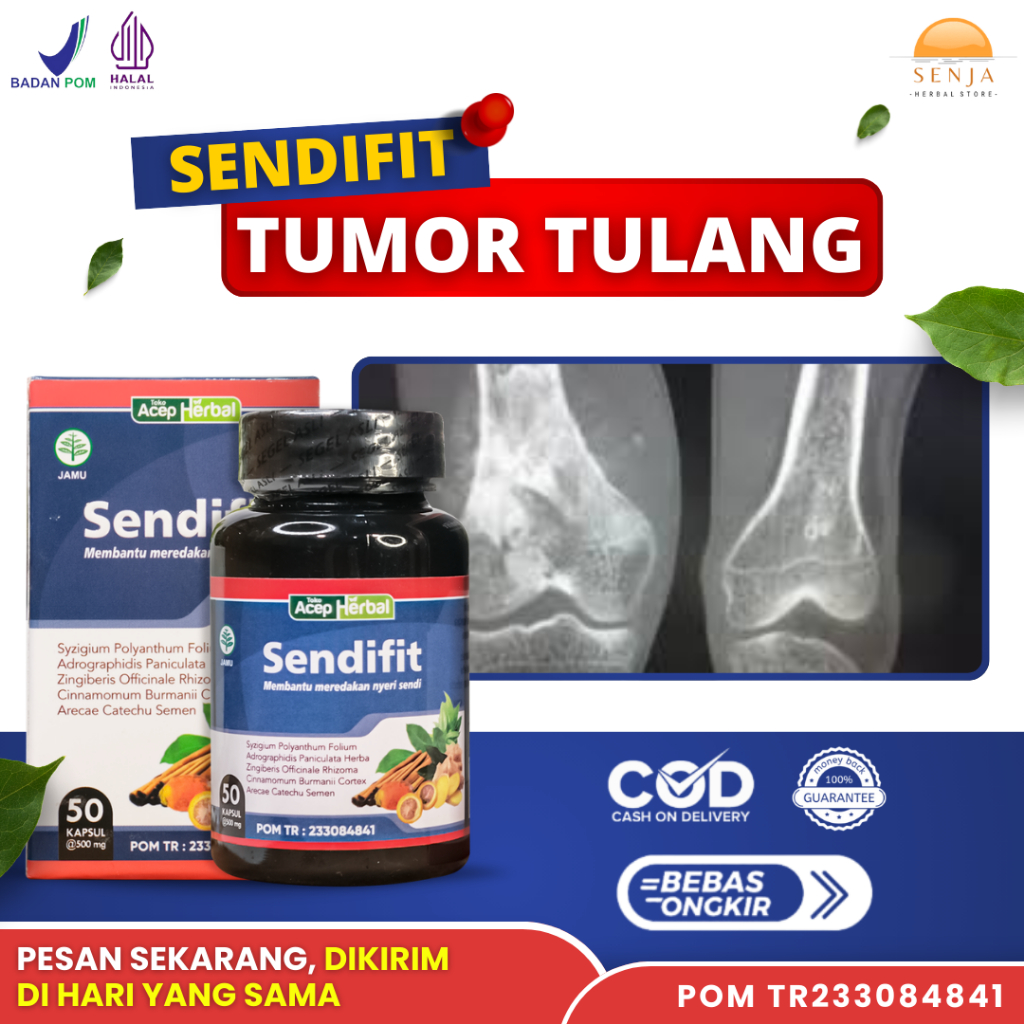 Pemulihan & Pengobatan Tumor Tulang, Obat Tulang Bengkak, Pengempes Benjolan Pada Tulang - SENDIFIT