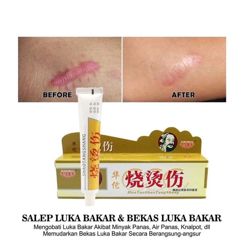 Salep luka bakar Penghilang Bekas Luka Keloid Operasi huatuo ShaoTangShang