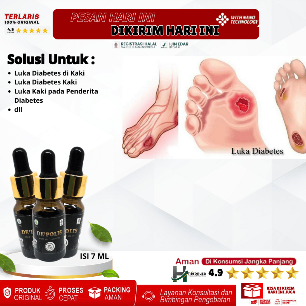 Obat Luka Diabetes di Kaki - Salep Penyembuh Luka Diabetes Kaki, Pengobatan Luka Kaki pada Penderita