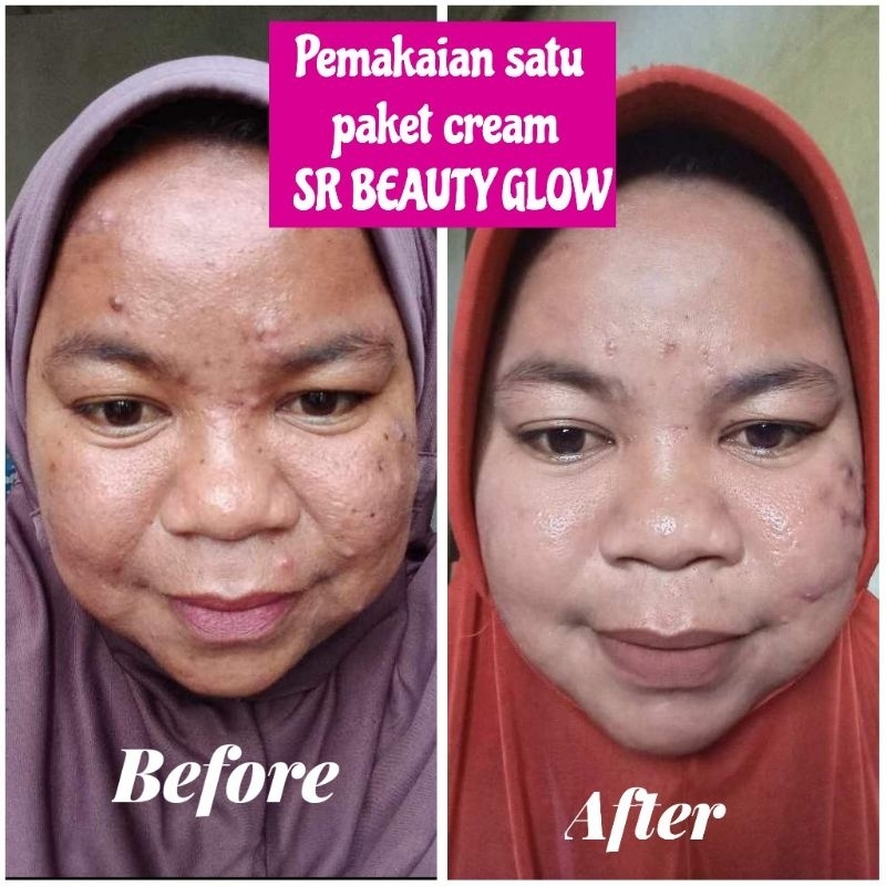 CREAM SR BEAUTY GLOW