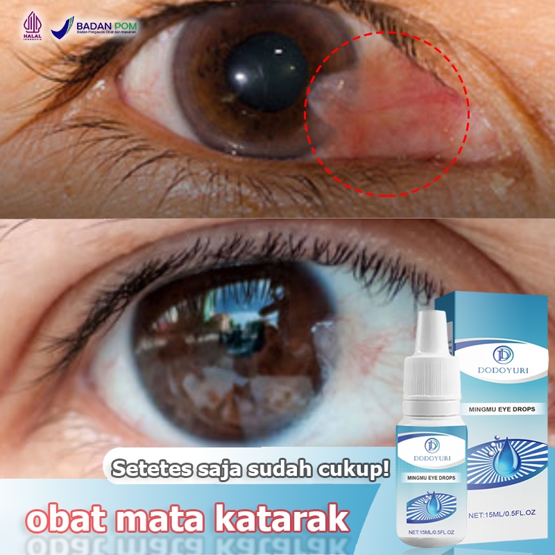 Obat mata katarak Obat mata minus Obat tetes mata Tetes mata 15ml Obat mata Obat katarak Obat tetes 