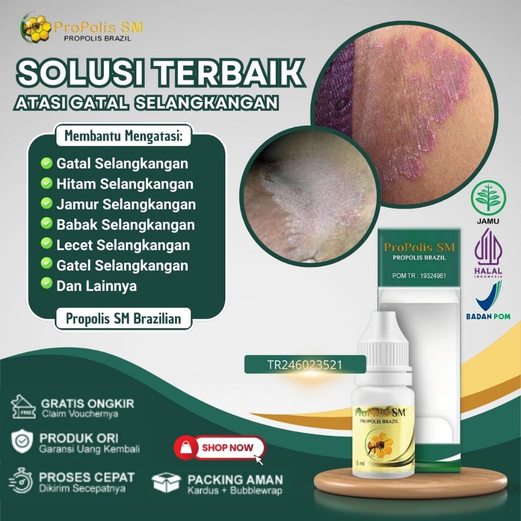 Obat Gatal Selangkangan, Obat Gatal Selangkangan Pria, Obat Gatal Selangkangan Wanita, Obat Penghila