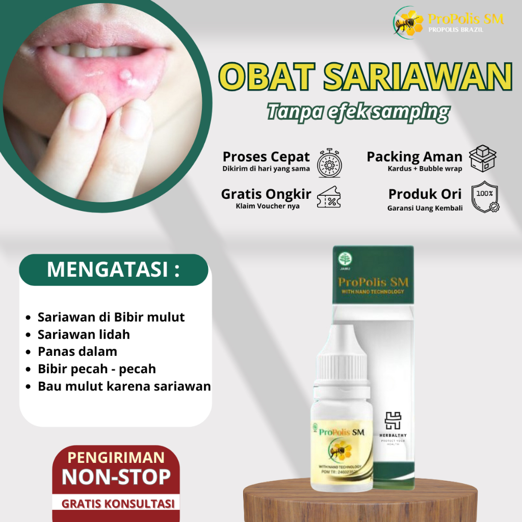 Obat Sariawan Di Bibir Sariawan Mulut Dan Lidah Panas Dalam Obat Radang Sariawan Menahun Obat Sariaw
