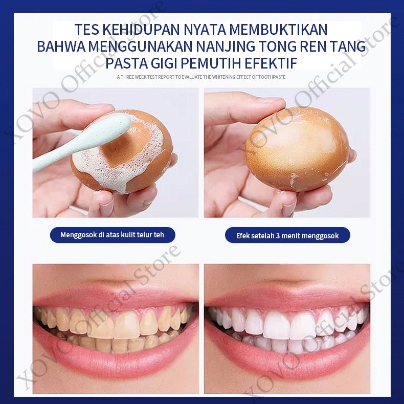 Odol Pemutih Gigi Dan Karang Gigi Penghilang Karang Gigi Membandel Pembersih Karang Gigi Pasta Gigi