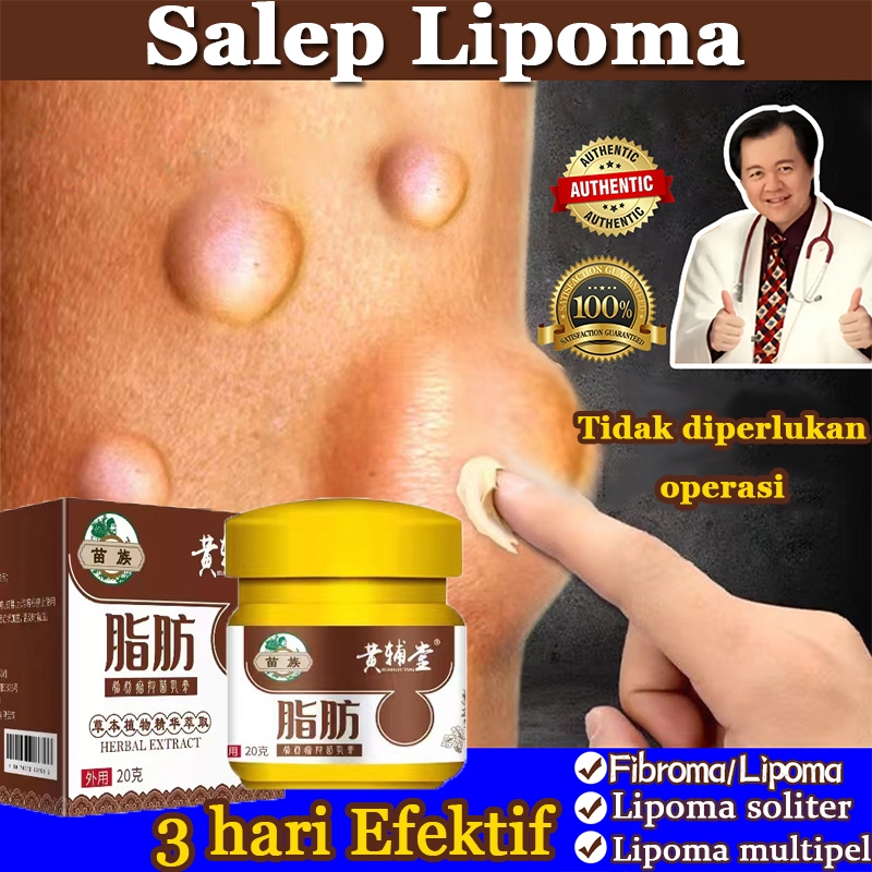 Lipoma Cream Krim Lipoma Obat Benjolan Penghilang Lemak Removal Salep Benjolan Obat Benjolan Payudar