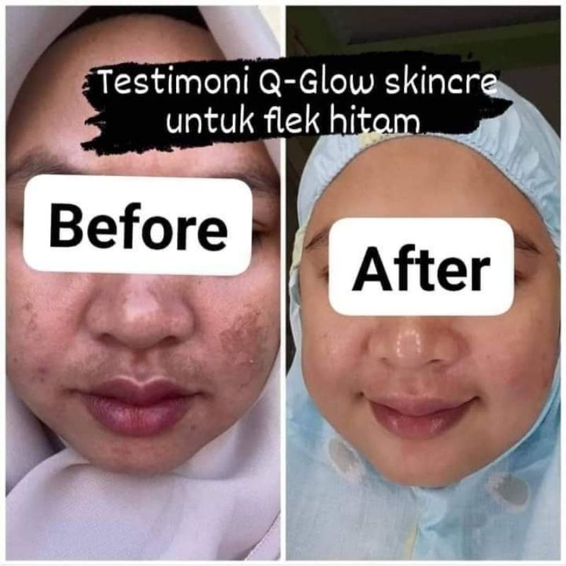 Q glow skincare