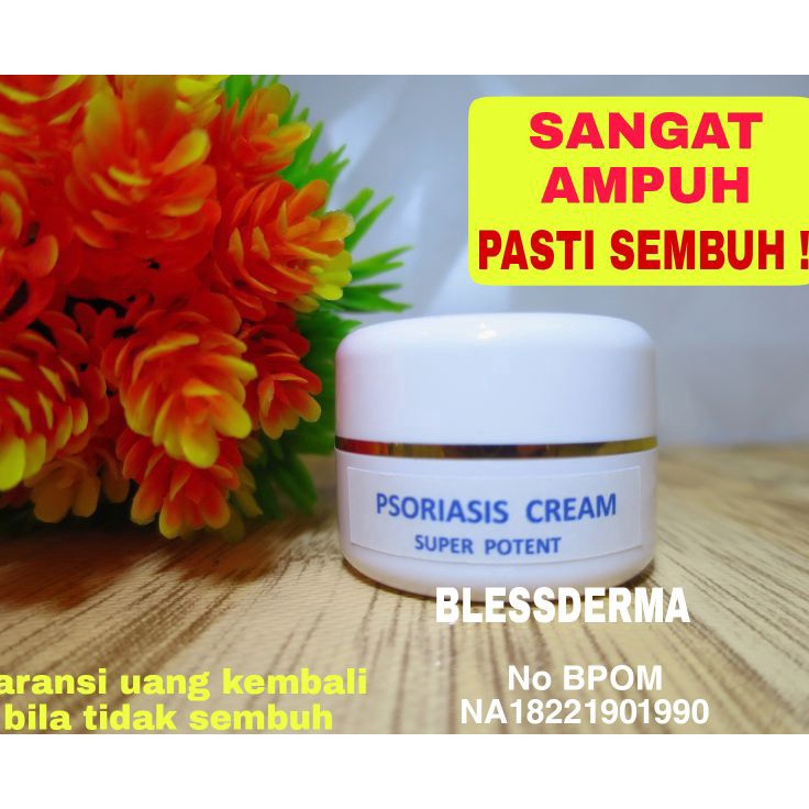 Rekomendasi PSORIASIS CREAM SUPER POTENT EKSIM GATAL BADAN TANGAN KAKI KEPALA RAMBUT