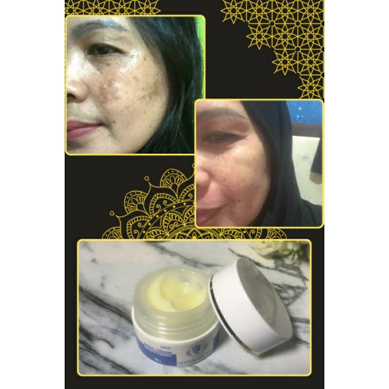 Cream Malam Brightening Shieshie MD Cream Flek Hitam Membandel Penghilang Flek Melasma BPOM Mencerah