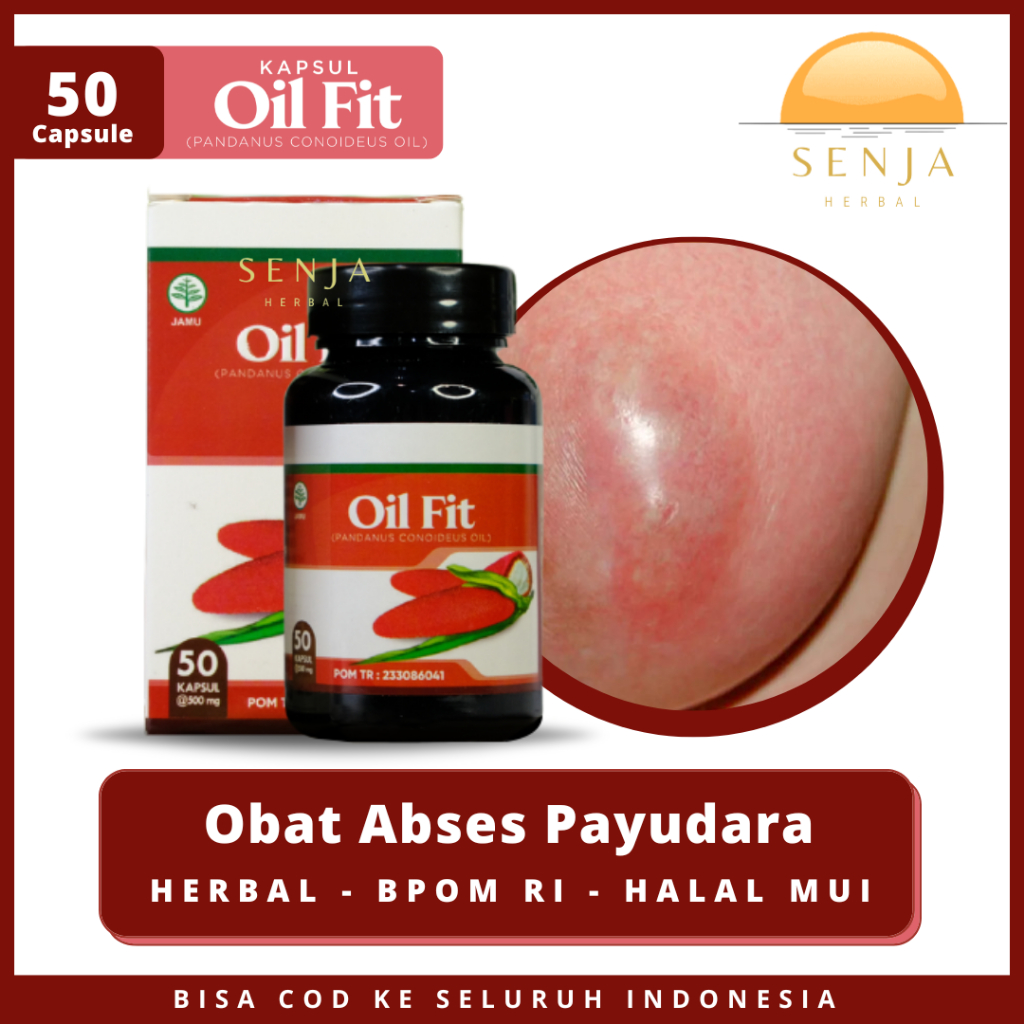 OilFit Obat Abses Payudara - Benjolan Payudara - Payudara Bengkak - Tumor Kista - Mastitis Payudara