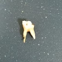 Gigi Praktikum Gigi Asli / Gigi Sulung Gigi Anak Molar