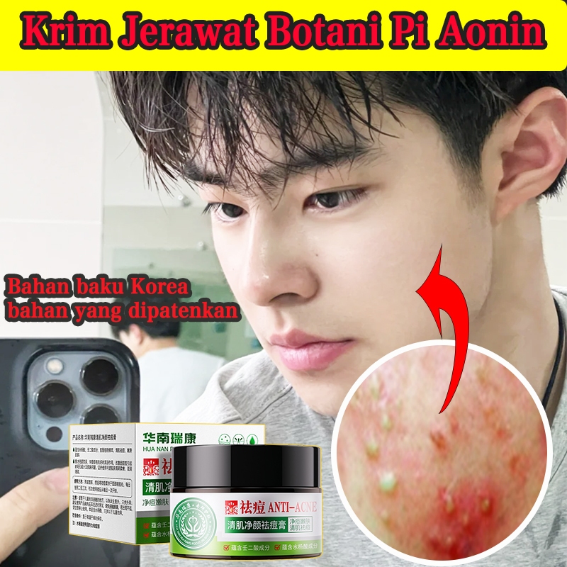 Obat jerawat dan bekas jerawat penghilang bekas jerawat salep jerawat penghilang bekas jerawat Mered