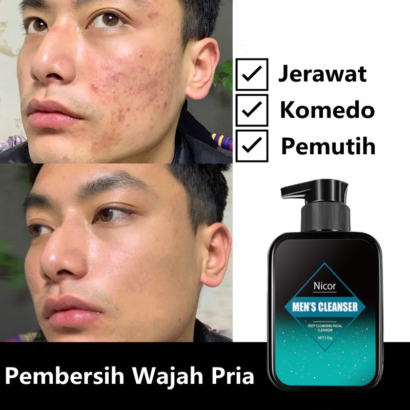 Pembersih Wajah Pria Facial Wash Acne Sabun Muka Pria Penghilang Jerawat Menghilangkan Komedo Mengon
