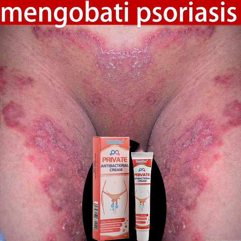 3 detik anti gatal Obat gatal selangkangan Obat psoriasis Obat Gatal-Gatal Salep gatal paling ampuh 