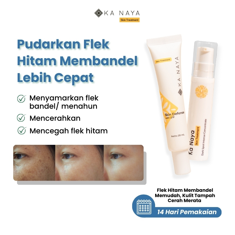 Ka Naya PAKET Dark Spot Night Whitening Salep Flek Hitam - Penghilang Bekas Jerawat - serum bekas je