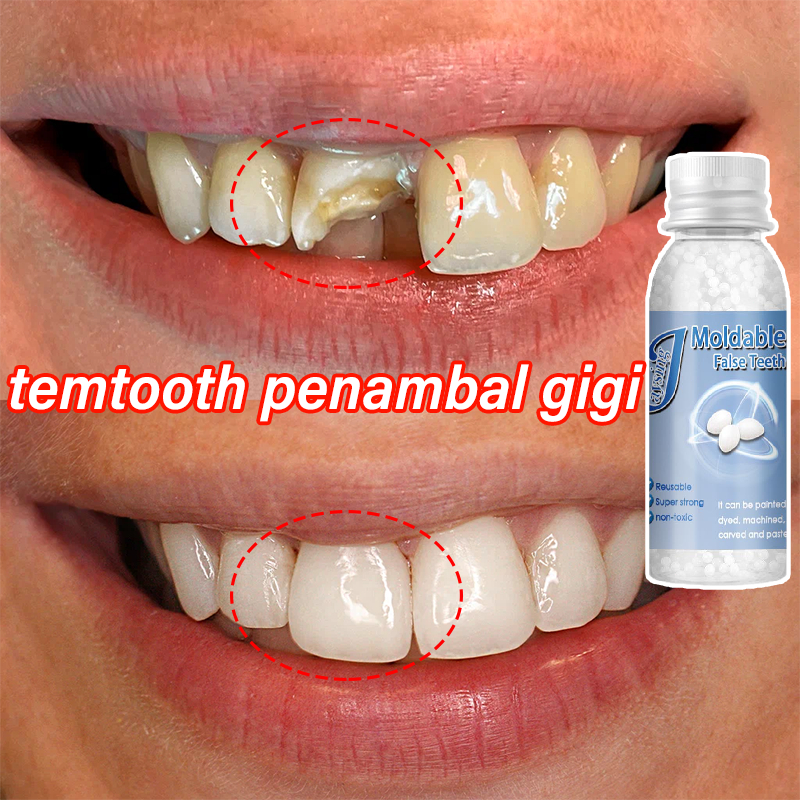 Penambal Gigi Berlubang Gigi Palsu Penambal Gigi Gigi Palsu Asli Permanen Bahan Gusi Gigi Palsu Keke