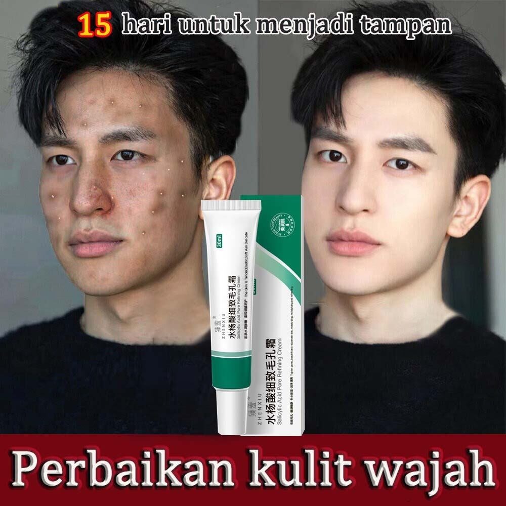 salep penghilang jerawat, krim penghilang flek hitam,salep jerawat ,penghilang flek hitam di wajah,s