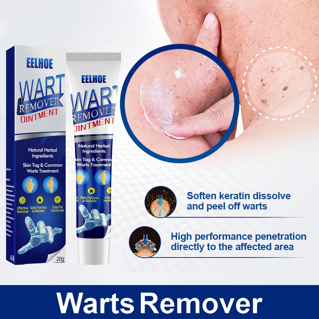 Eelhoe Wart Remover Dintment