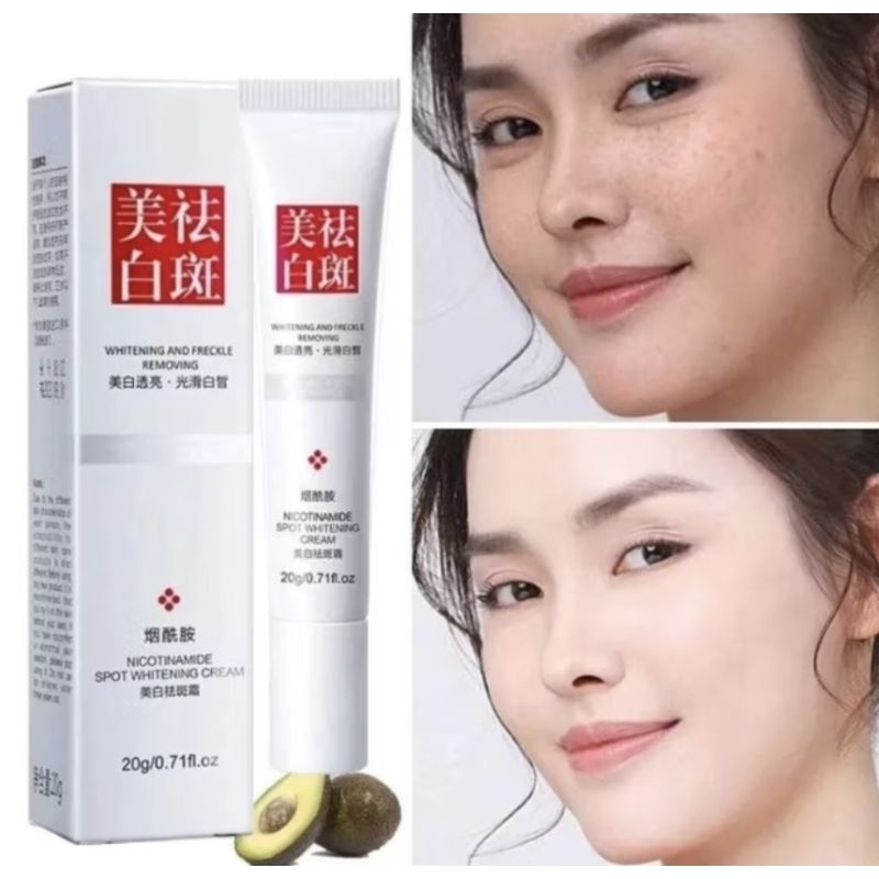 Fuyan Spot whitening cream