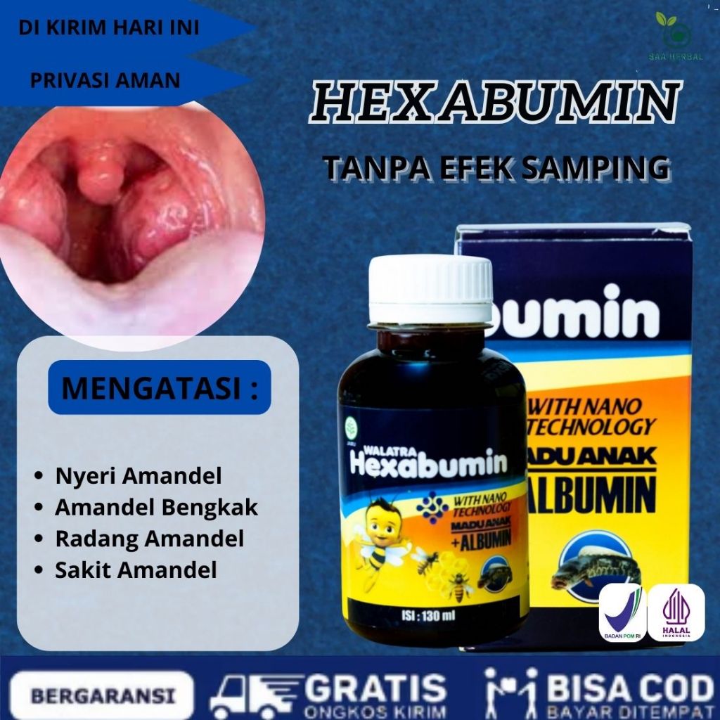 Hexabumin - Obat Nyeri Amandel, Amandel Bengkak, Radang Amandel, Sakit Amandel ASLI