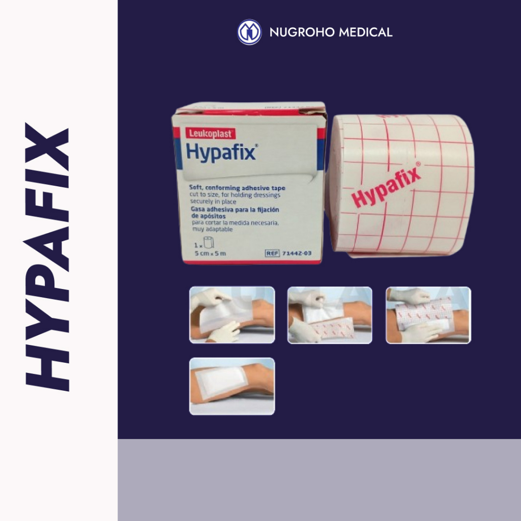 Hypafix 5cmX1m/Plester Anti Alergi Hypafix 5cmX1meter/Hipafix 5X1