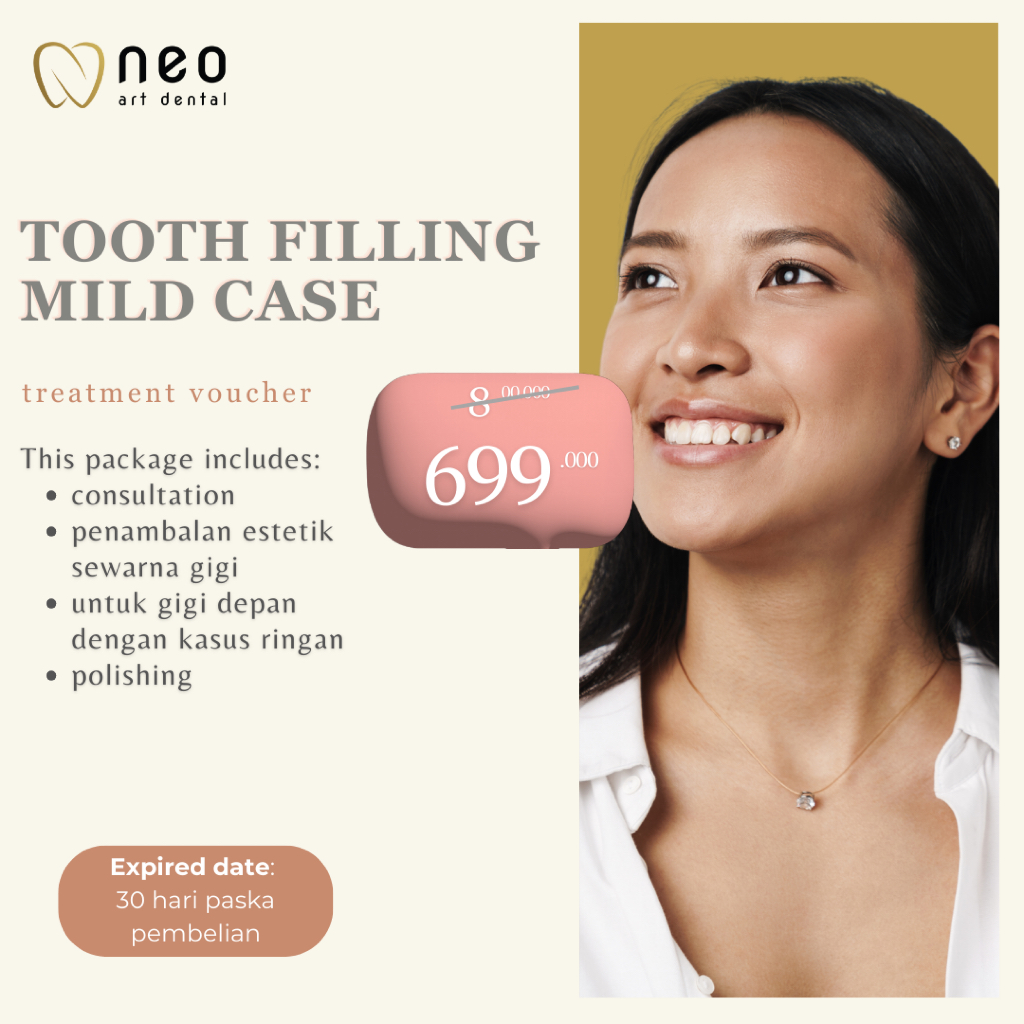 NEO ART DENTAL - VOUCHER PENAMBALAN GIGI DEPAN KASUS RINGAN / MILD + POLISHING