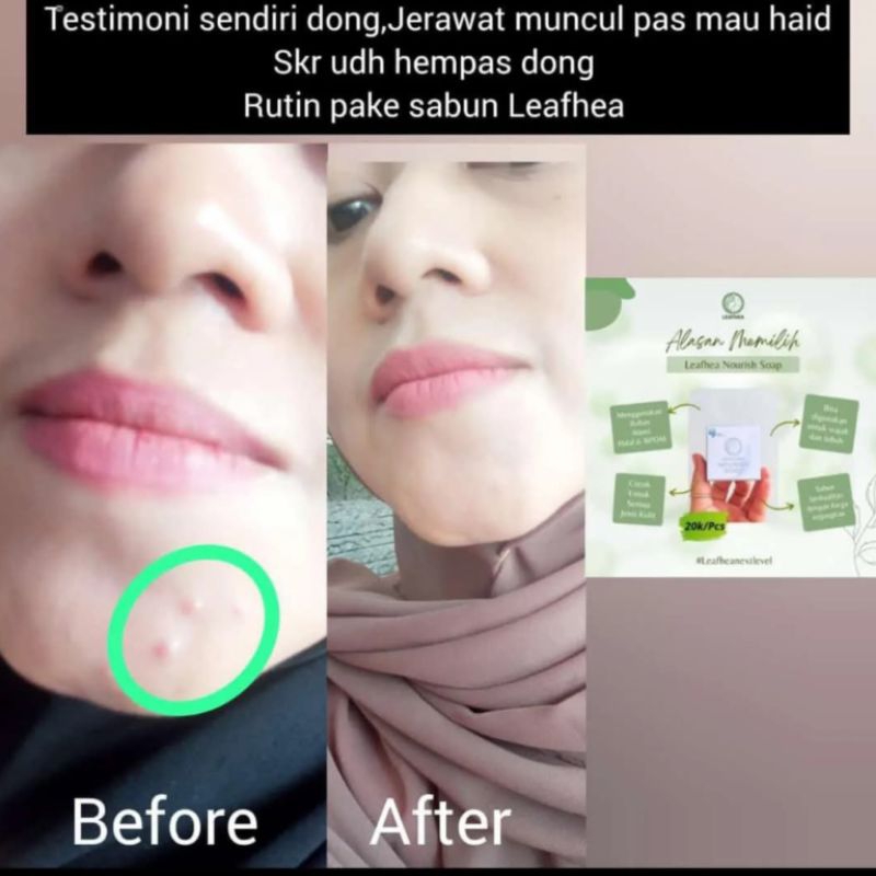 Sabun Leafhea ,sabun glowing,sabun multifungsi,sabun bahan alami,sabun muka,aman bumil dan busui