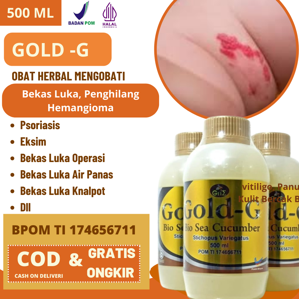 Gold-G Asli Original - Penghilang Bekas Luka, Penghilang Hemangioma, Penghilang Tanda Merah Aman Unt