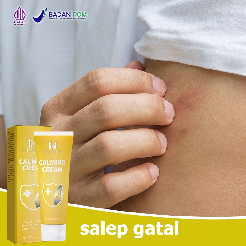 loli Obat gatal selangkangan Salep gatal selangkangan Obat gatel selangkangan Gatal selangkangan