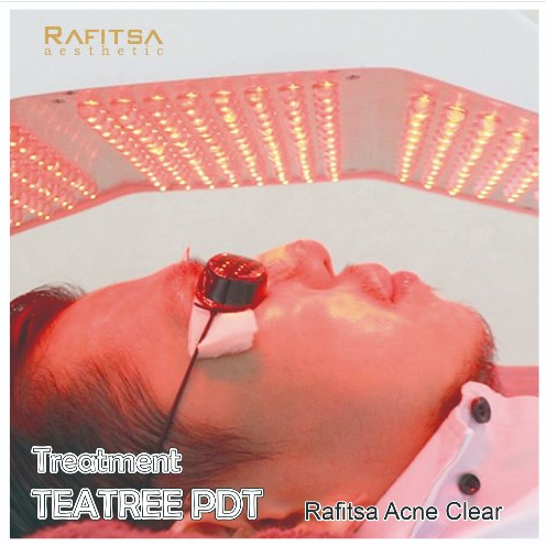 RAFITSA VOUCHER TREATMENT TEATREE PDT